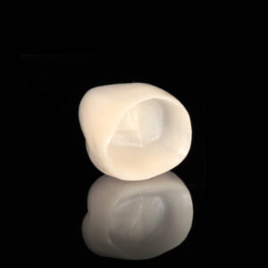 Corone in zirconia: come appaiono e perché sembrano naturali Corone in Zirconia