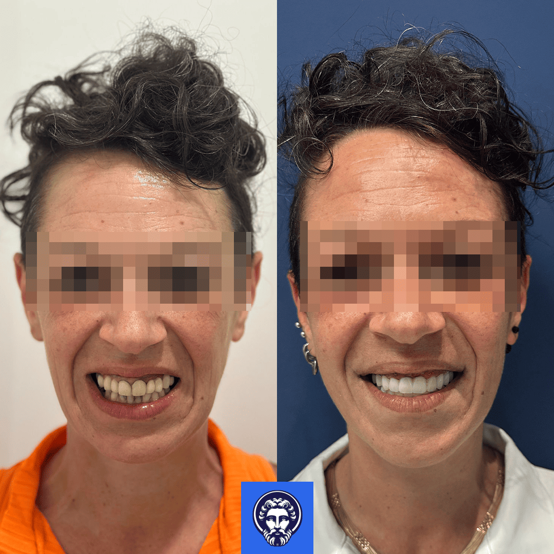 ilenia medas before_after