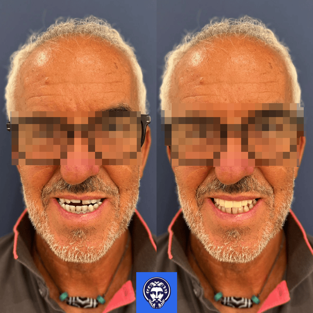 nicola before_after
