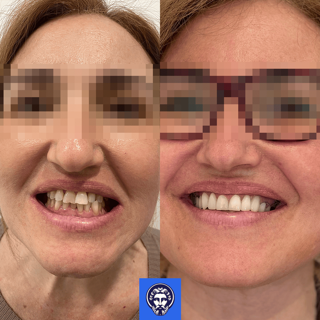 rosa capuano before_after