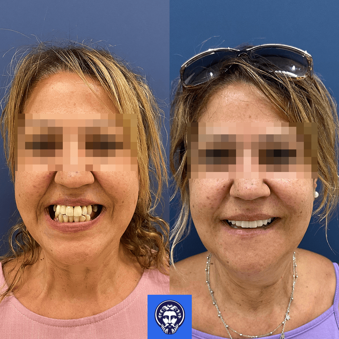 teresas zito before_after