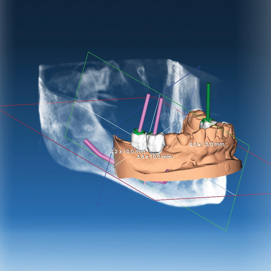 Consulto Gratuito Milano tecnologia dentale avanzata