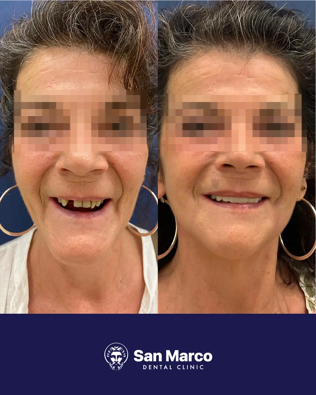 Paziente italiano soddisfatto