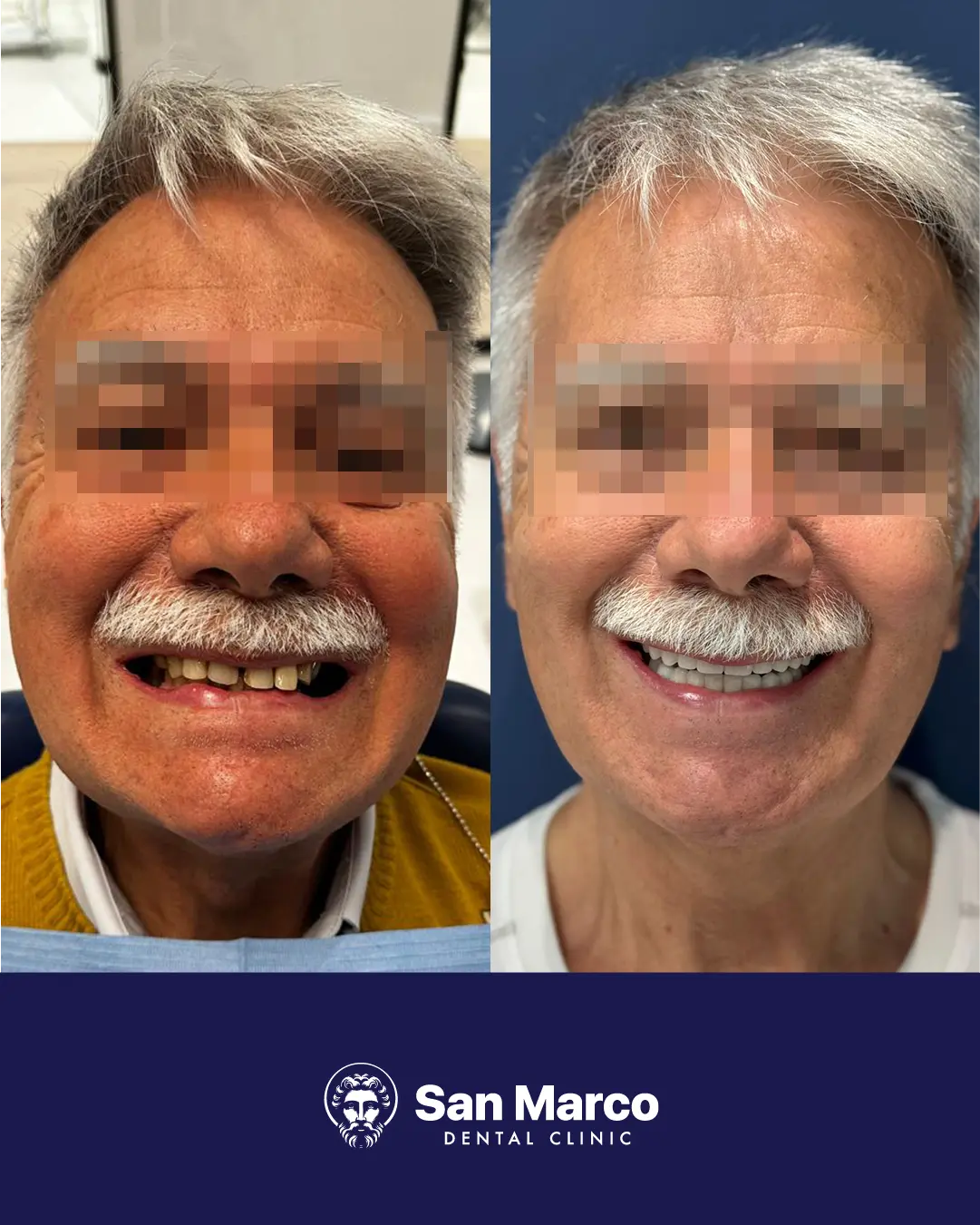 Paziente San Marco Dental