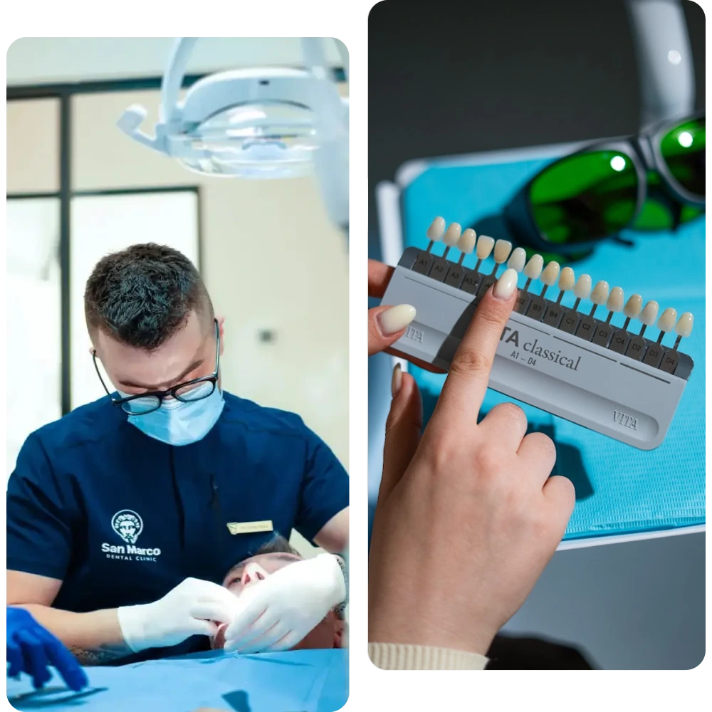 garanzia san marco dental